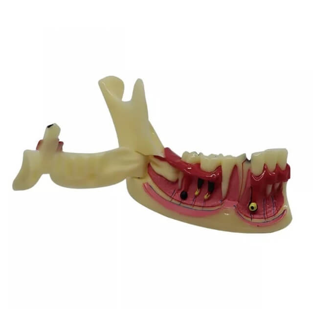Модель ендодонтичного лікування зубів