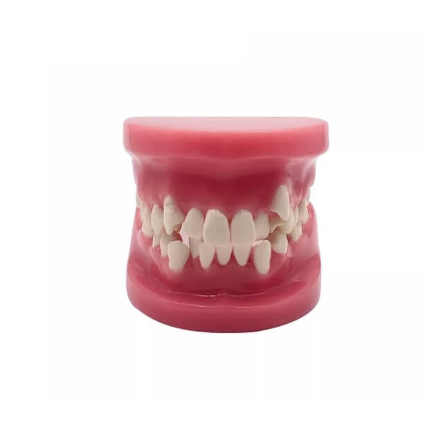 Стоматологічна модель зубів, модель прикусу зубів